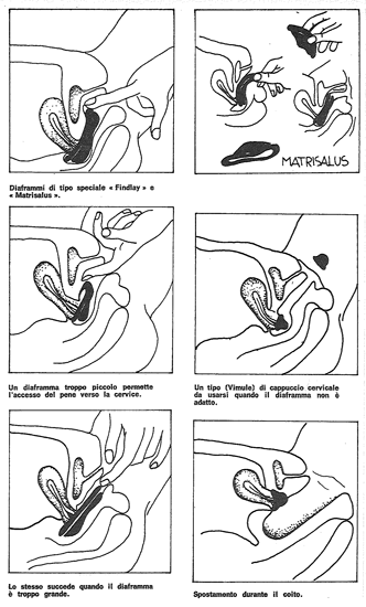 05_1977_metodi-contraccettivi-per-la-donna_f1