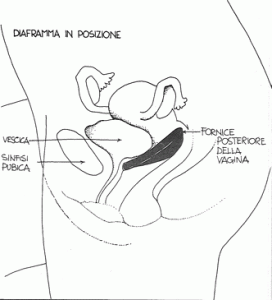 05_1977_metodi-contraccettivi-per-la-donna_f4